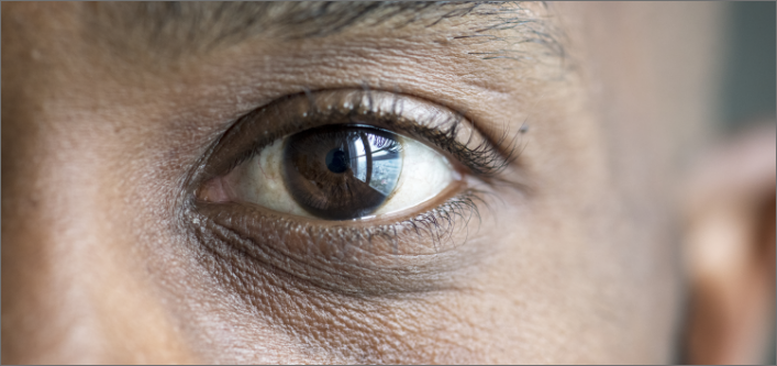 brown eyes